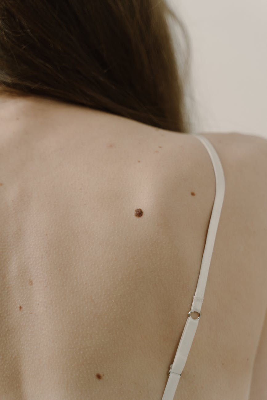 white strap on bra on woman back